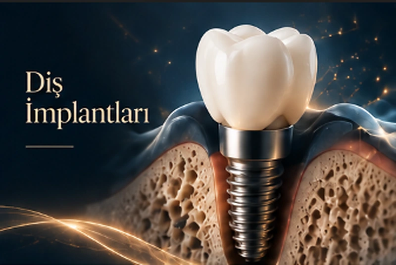 İmplant Uygulamaları